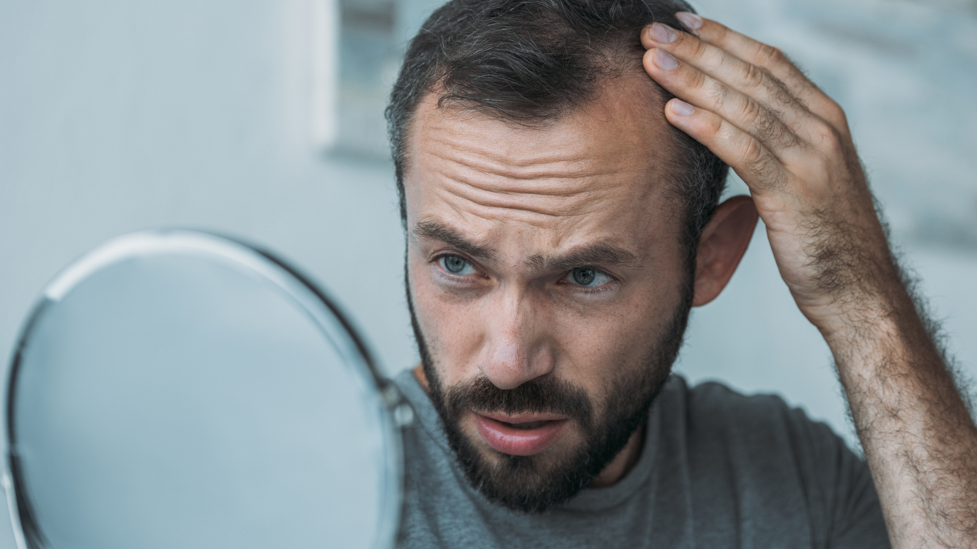 Tratamientos para la Alopecia