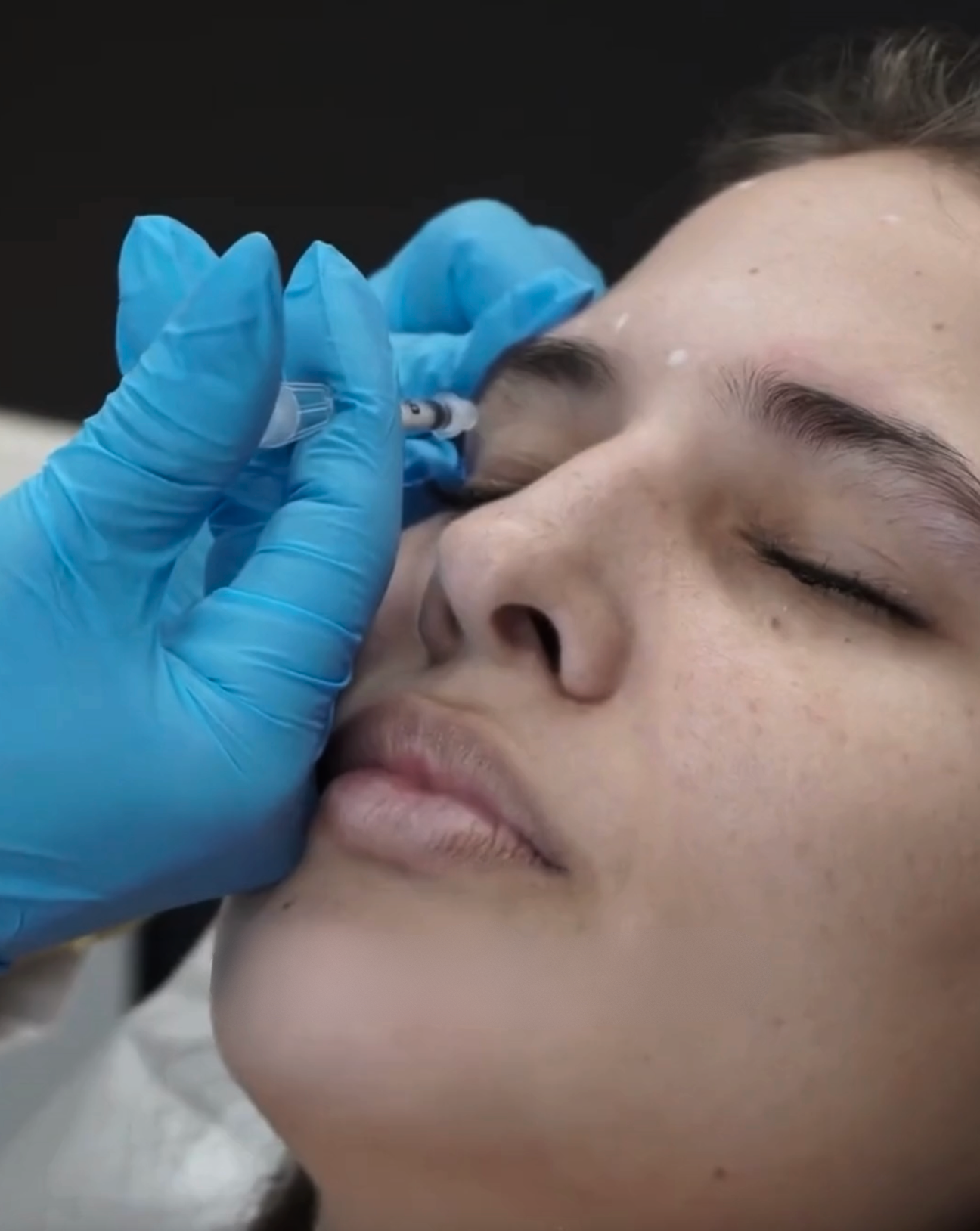 Toxina Botulínica Tipo A