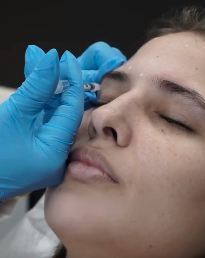 Toxina Botulínica Tipo A